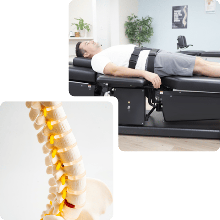 Man lying on a spinal decompression table, and a model of a human spine
