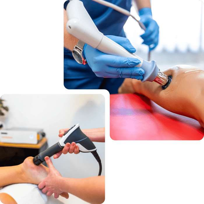 Shockwave therapy devices being applied to a patients leg and foot.