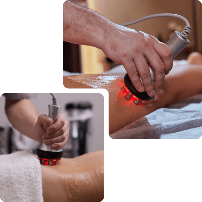 Hands using laser devices for deep tissue therapy treatment